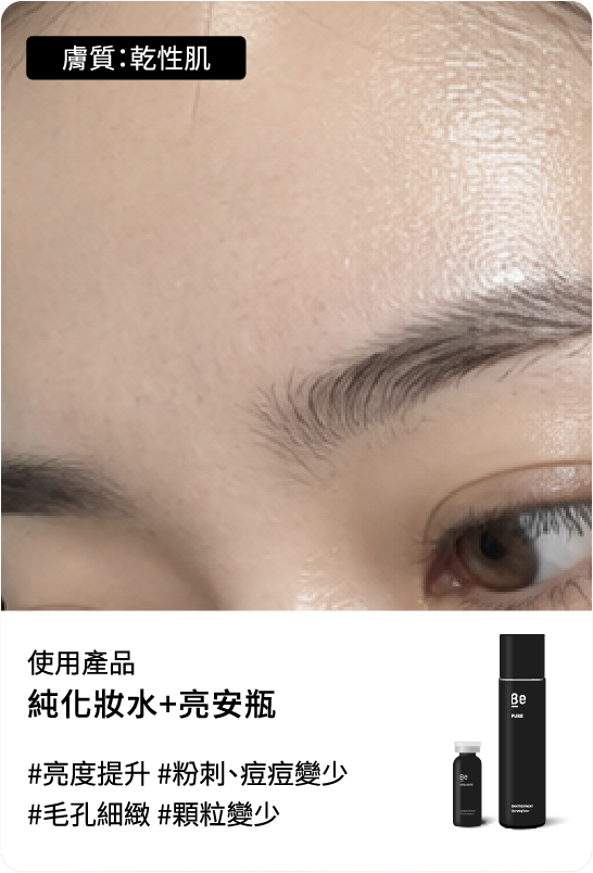 Be友分享圖片 8，保濕安定養肌組