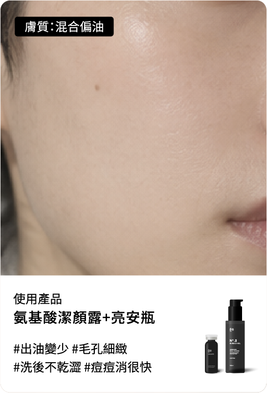 Be友分享圖片 5，肌膚平衡組