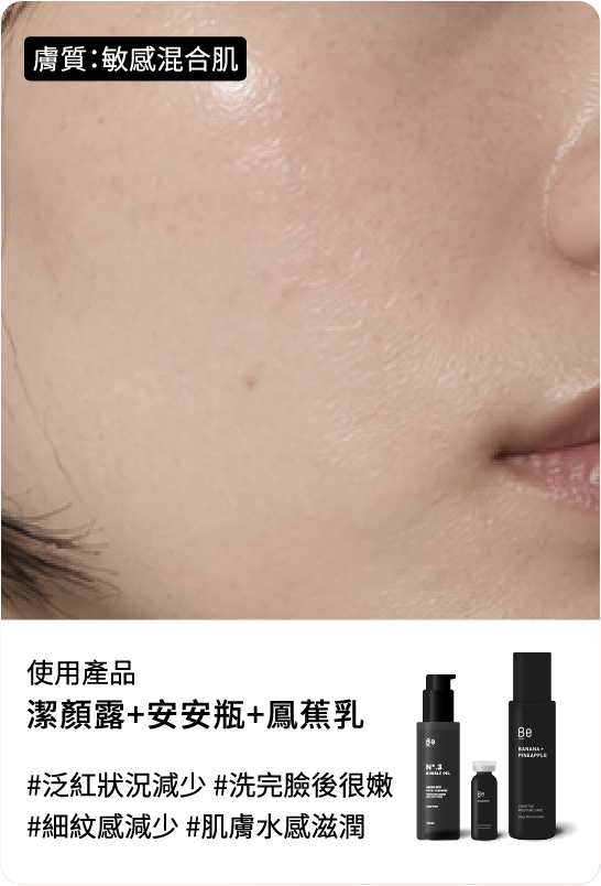 Be友分享圖片 6，輕透安定保濕組