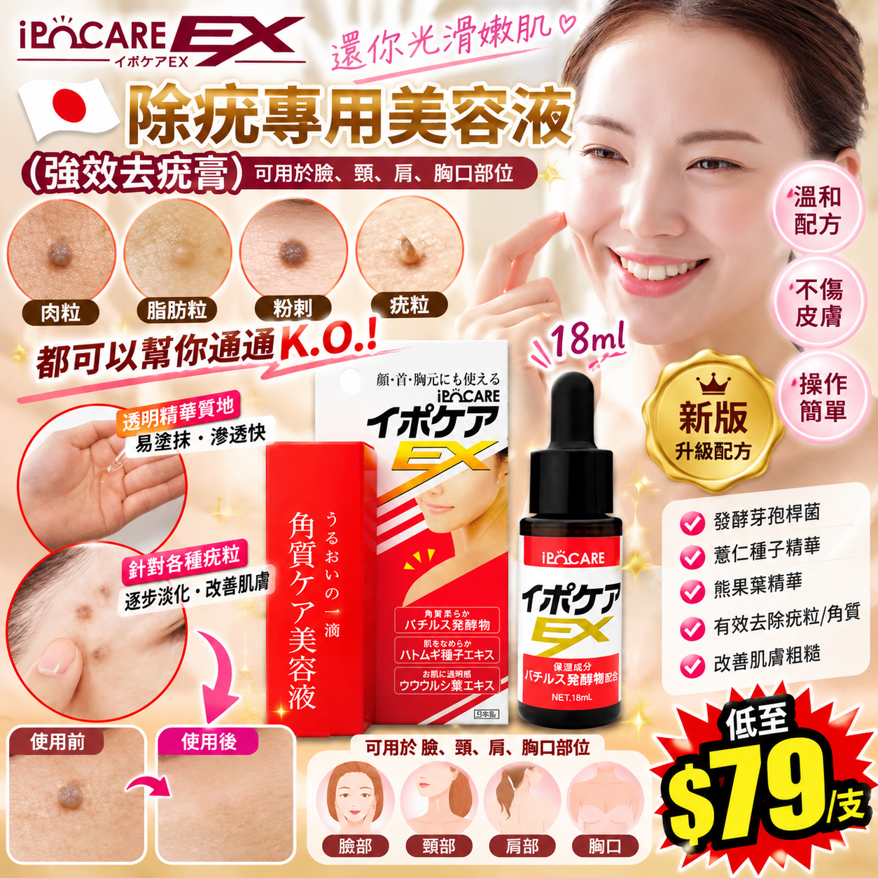 【UB10302】日本IPOCARE除疣專用美容液 (新版) 18ml