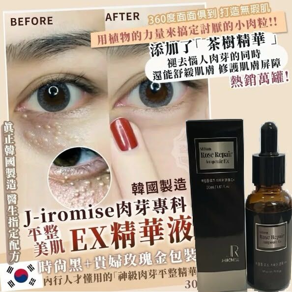 WSBB0292   韓國製造 J-iromise肉芽專科 平整美肌 EX精華液30ml（12月上旬）