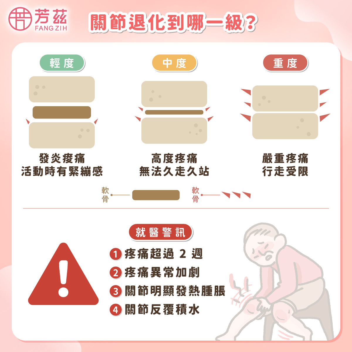 關節退化到哪一級?