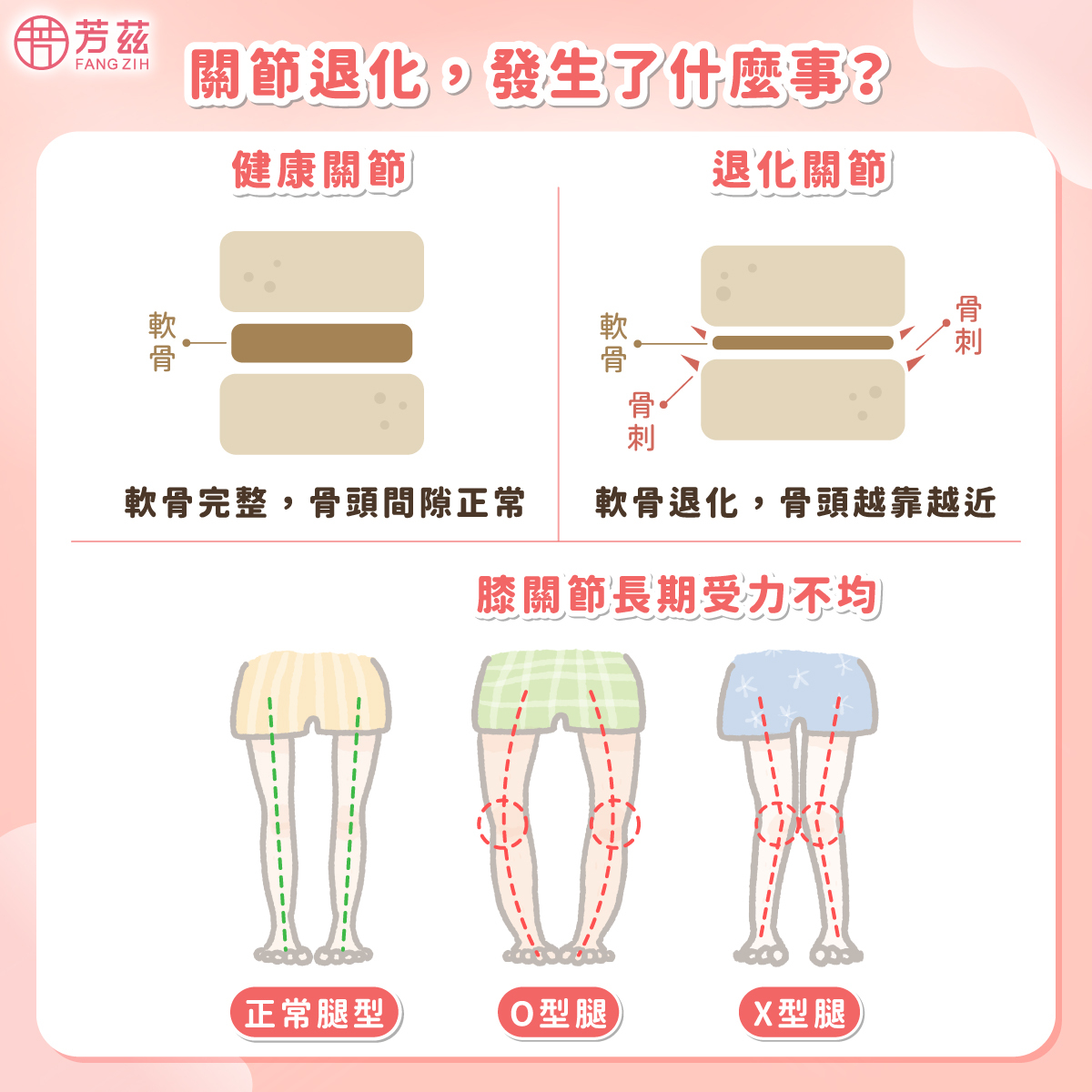 關節退化,發生了什麼事?