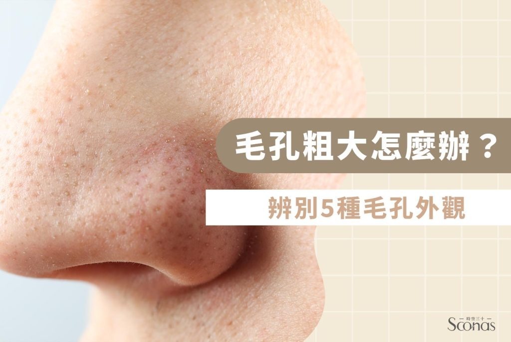 毛孔粗大怎麼辦