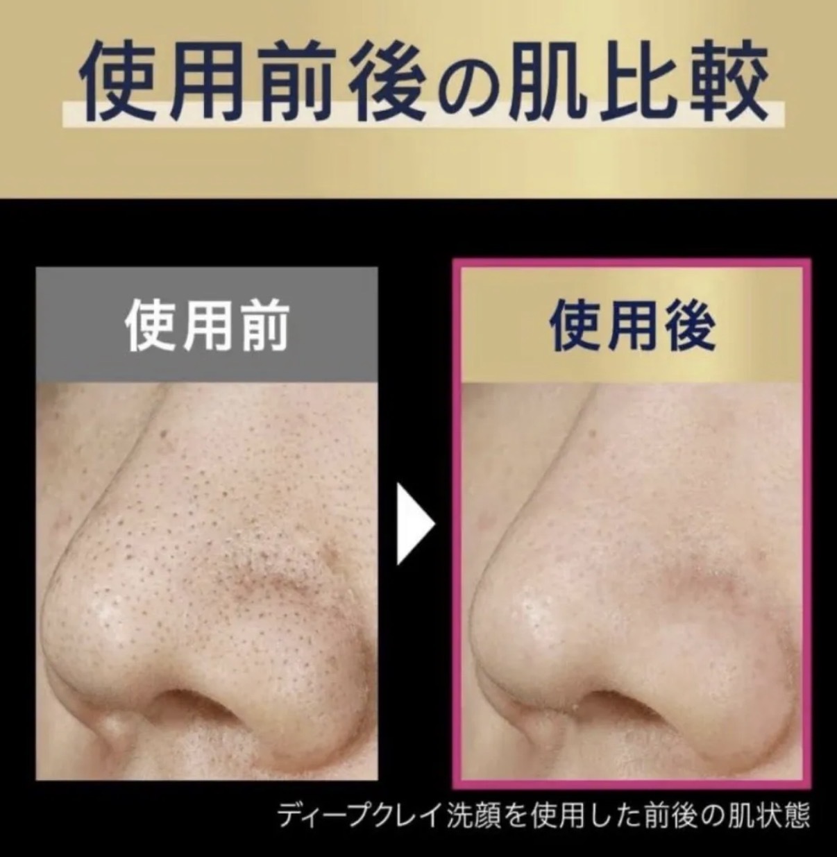 【超級難搵】JP 角栓崩壊 x 美容院級 Biore 深層毛孔黑炭泥洗面乳 180g 4057 TK261009