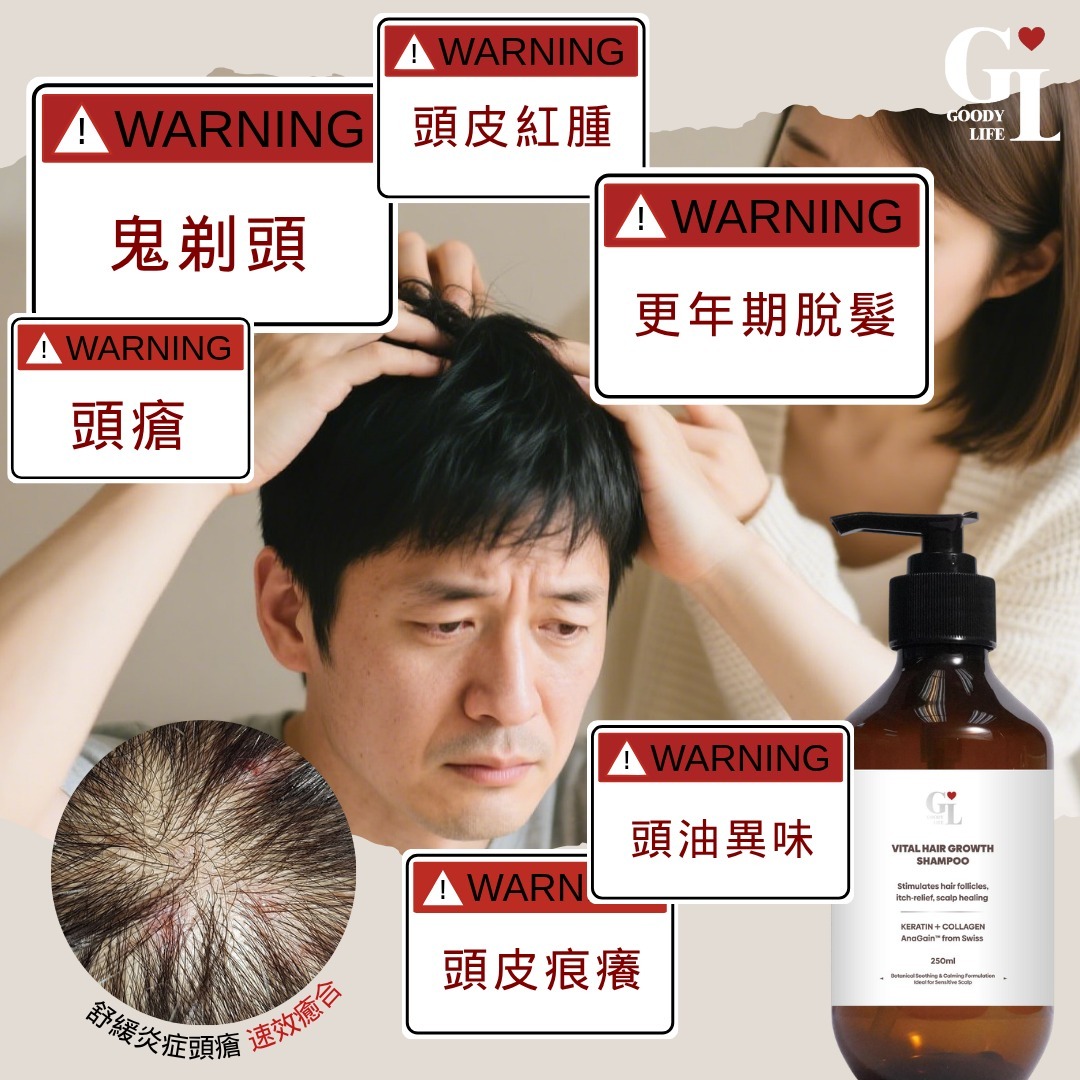 皮膚炎症 ｜皮膚敏感 ｜牛皮癬｜ 紅疹 ｜皮膚痕癢 ｜痕癢肌 ｜乾燥肌 ｜ 天然成份 ｜中西醫推介 ｜無藥性 ｜不含類固醇