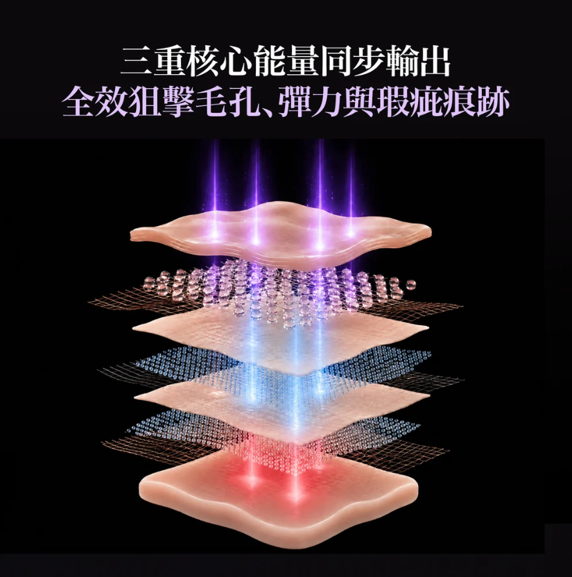 AB261012 - E2 EOA FULTENZA RF 毛孔緊緻美容儀 送 EOA 膠原水光美容儀導入啫喱 200ml * 1 + EOA緊緻毛孔安瓶精華 30ml * 1 + EOA雙效修護舒緩膠囊面霜 55g * 1 + EOA抗皺毛孔澎潤水光噴霧  80ml * 1 gogo紫色還原珍珠手串*1 + 雅詩蘭黛化妝袋*1