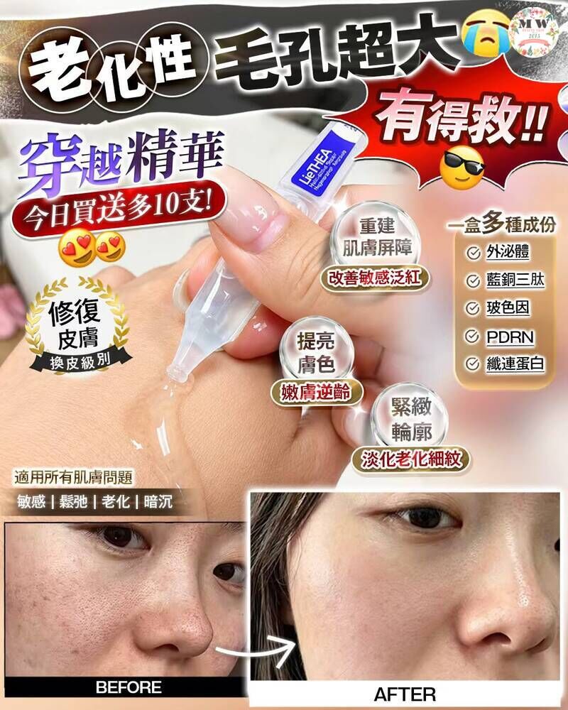 【醫美級五大王炸】高濃極速修復穿越精華次拋 (PDRN+外泌體+藍銅胜肽+玻色因) | 填平凹凸洞 退紅去黃