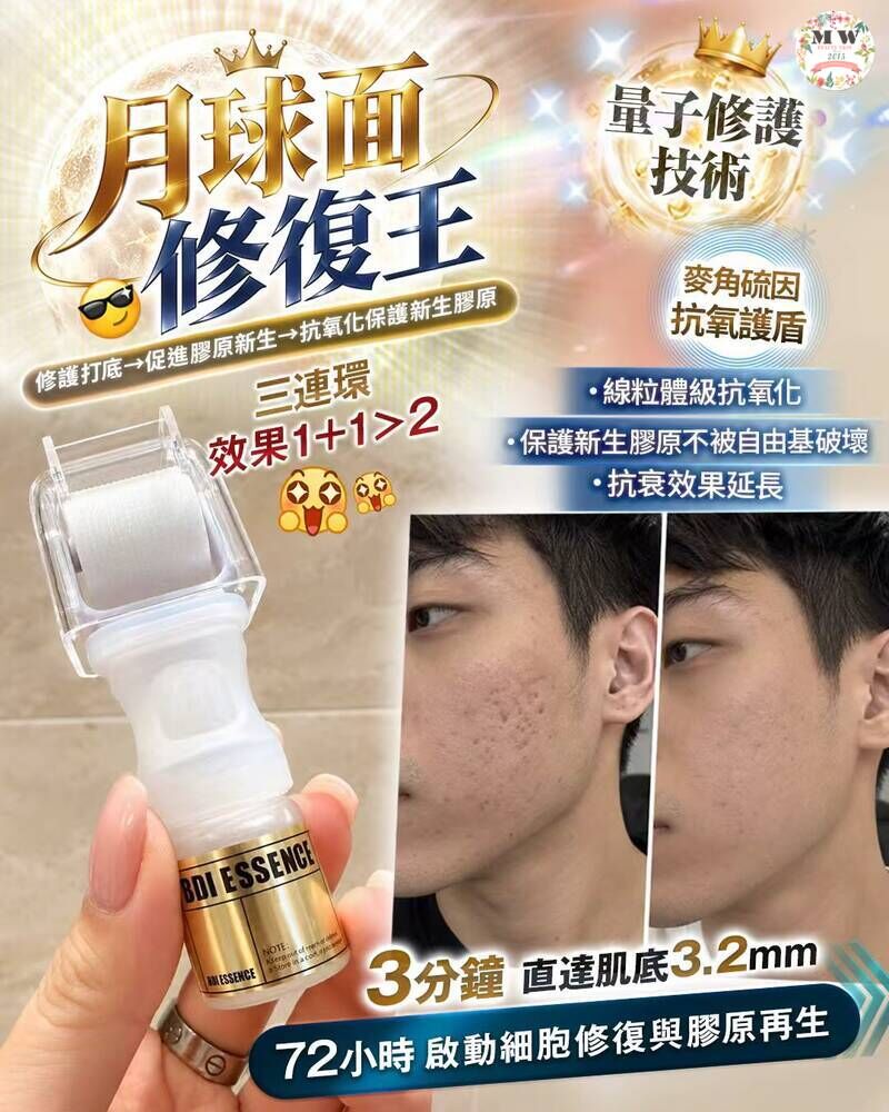 【送可溶性微針滾輪】醫美級月球面修復王 (PDRN三文魚DNA+棕櫚酰五肽-4)｜零創傷填平凹凸洞・淡化痘坑痘印