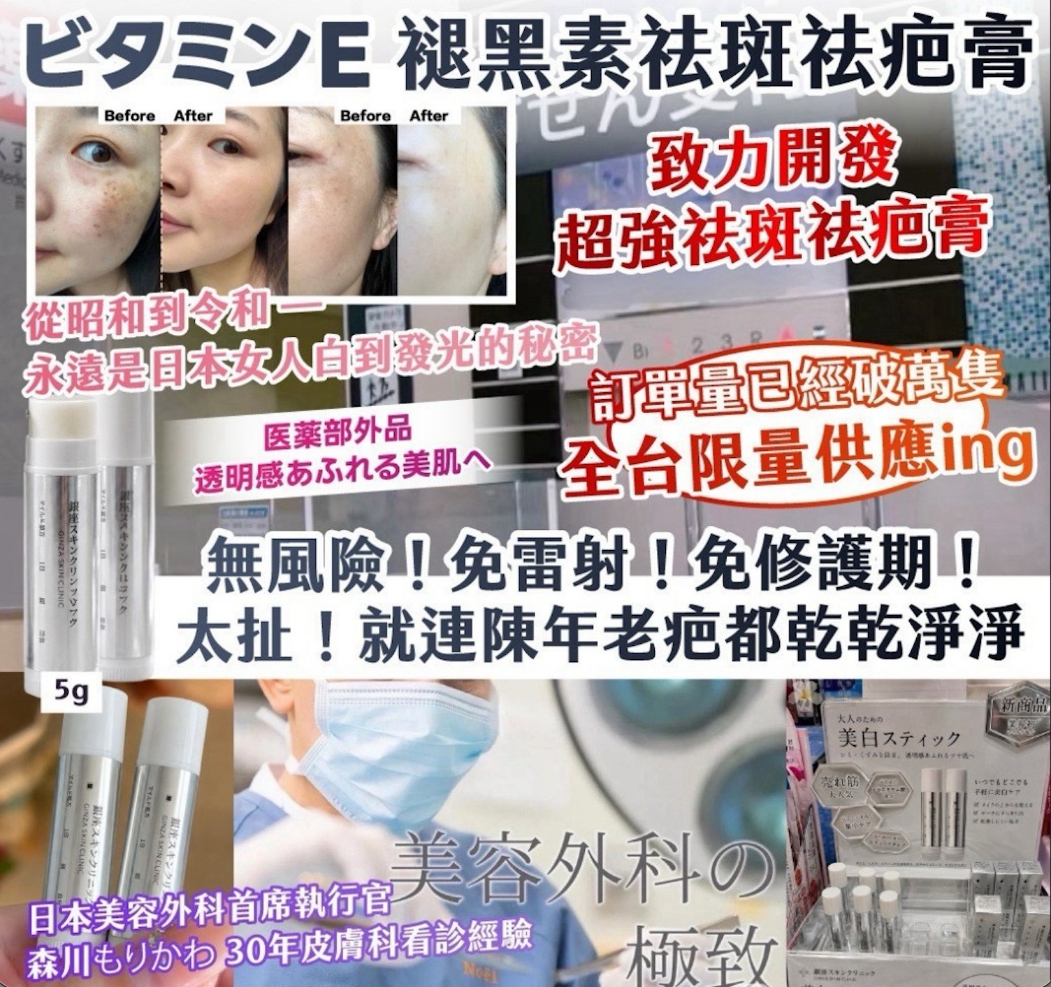 WSBB12565   銀座Z美容外科®院內ビタミンE 褪黑素祛斑祛疤膏 5g（12月上旬）