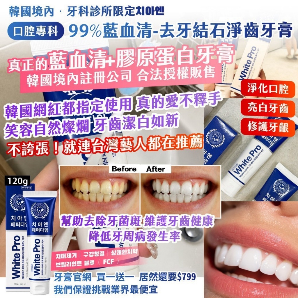 WSBB13053   🇰🇷韓國境內·J-iromise牙科診所限定 치아엔 ｜口腔專科｜99%藍血 清-去牙結石淨齒牙膏120g （1套2支）（12月上旬）