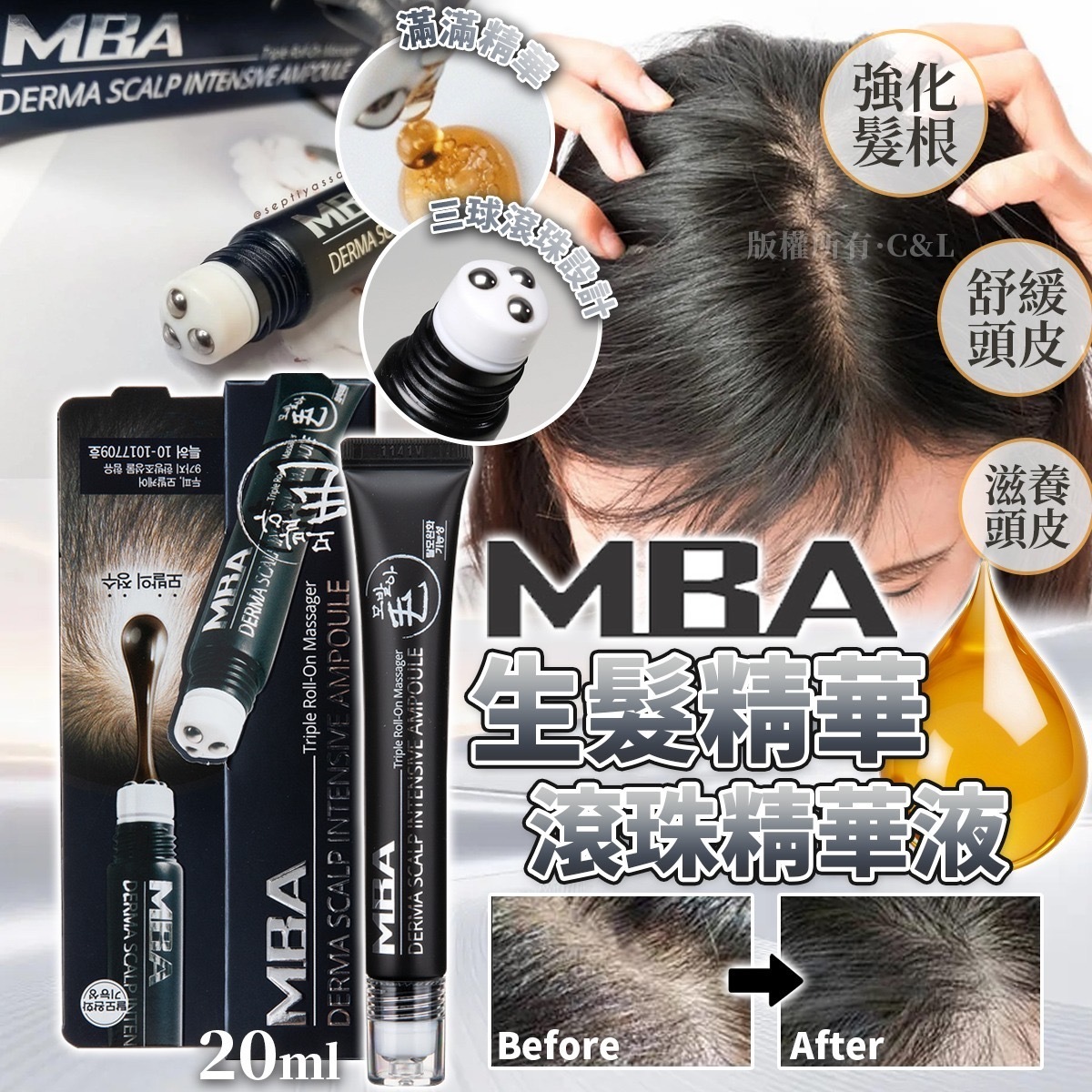 MBA生髮精華滾珠精華液20ml