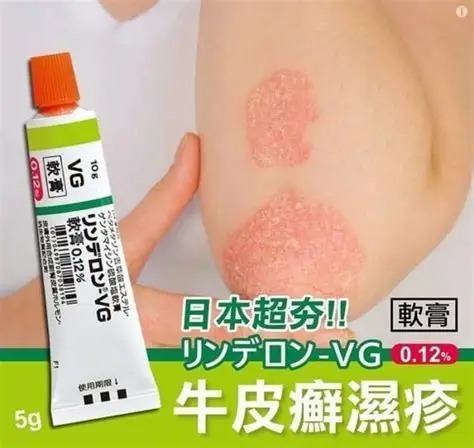 日本VG成人濕疹膏5g（H2610 PB873）