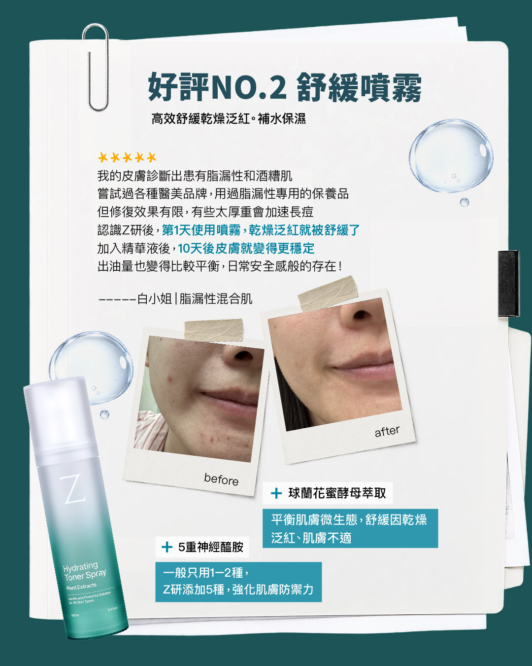 好評NO.2 舒緩噴霧｜白小姐使用分享