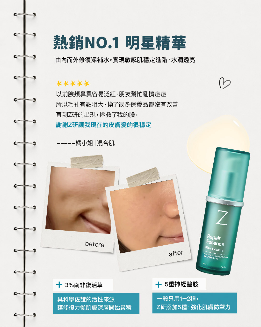 熱銷NO.1 明星精華｜橘小姐 混合肌使用分享