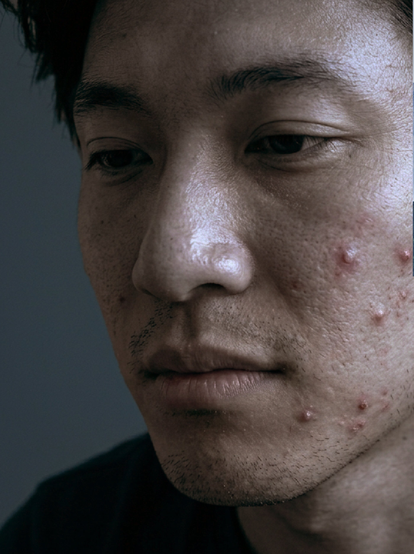 男性臉部真實膚況近距離攝影
