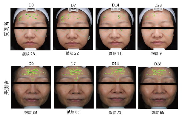 安瓶官網公開的兩位受測者皺紋觀察照片,依序為 D0、D7、D14、D28,保留原始遮眼及分析標記