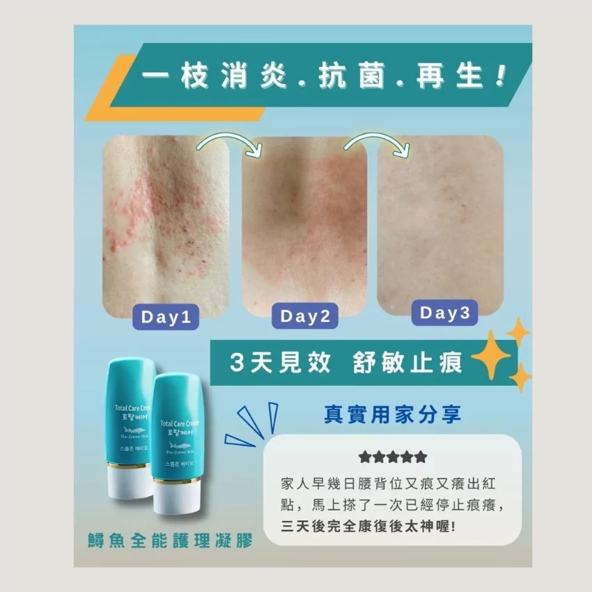 鱘魚全能護理凝膠 50ml (濕疹、火傷、再生、去疤專用) （H2610 PB900）