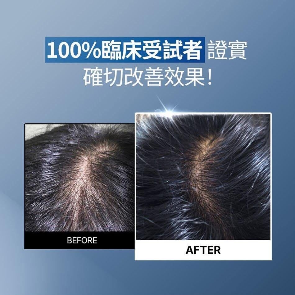 Epais Scalp Boosting Ampoule 強韌髮根頭皮精華150ml