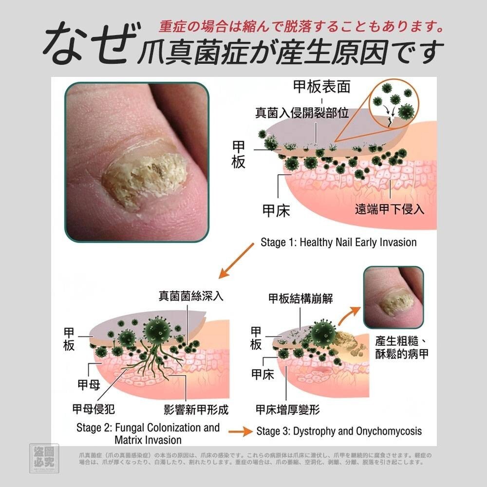 WSBB11865  日式 灰甲保健貼20貼（12月中旬）